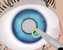 Eye Surgery Poster image of Eye Surgery game