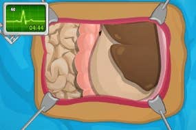 Screenshot image of OPERATE NOW: STOMACH SURGERY game